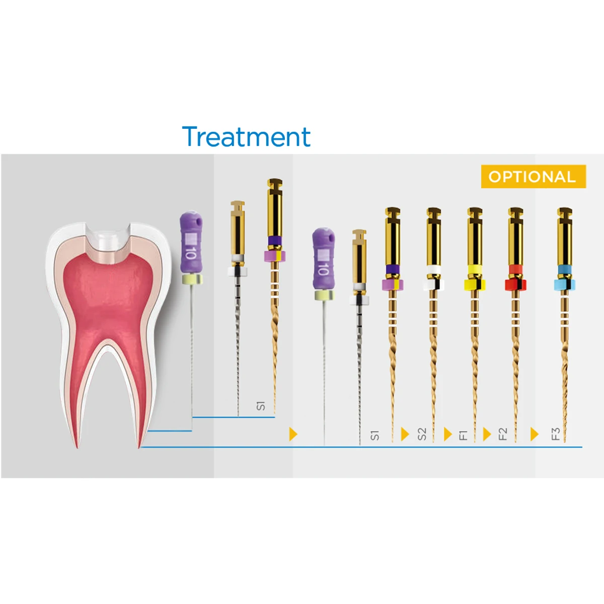 1Pack Dental Endodontic Gold Taper NITI Rotary Files Engine Use Expansion  25mm,SX-F3