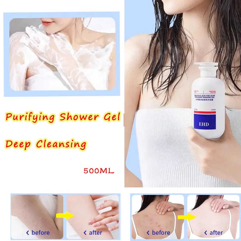 Purifying Shower Gel - Deep Cleansing for Oily & Acne-Prone Skin - Reduces Breakouts & Unclogs Pores - Refreshing Fragrance