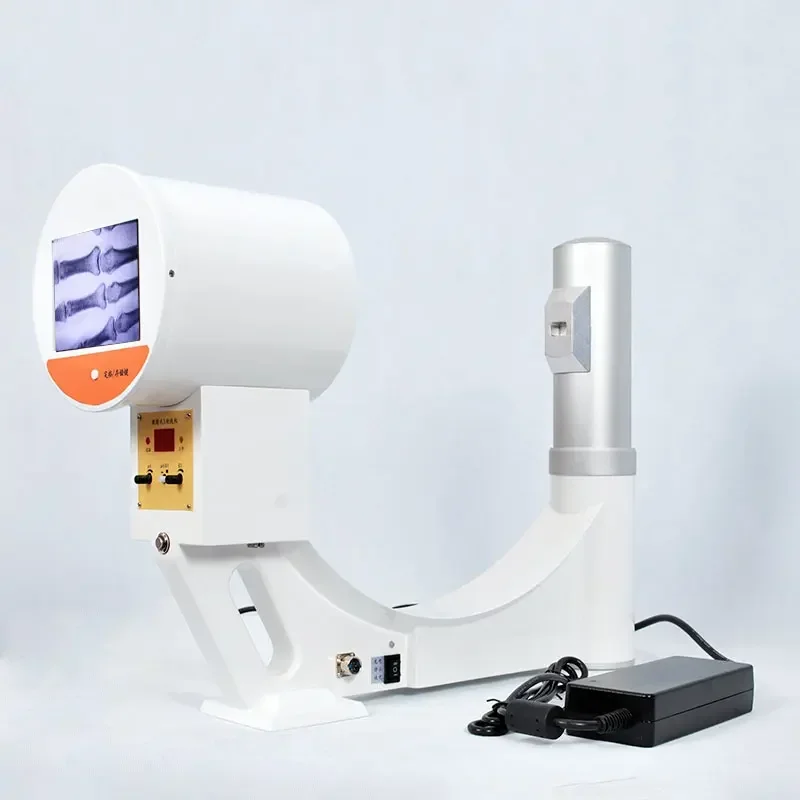 Limbs Chip Electronic Pottery Antique Fluoroscopy Equipment Orthopedic Portable X-Ray Fluoroscopy Machine