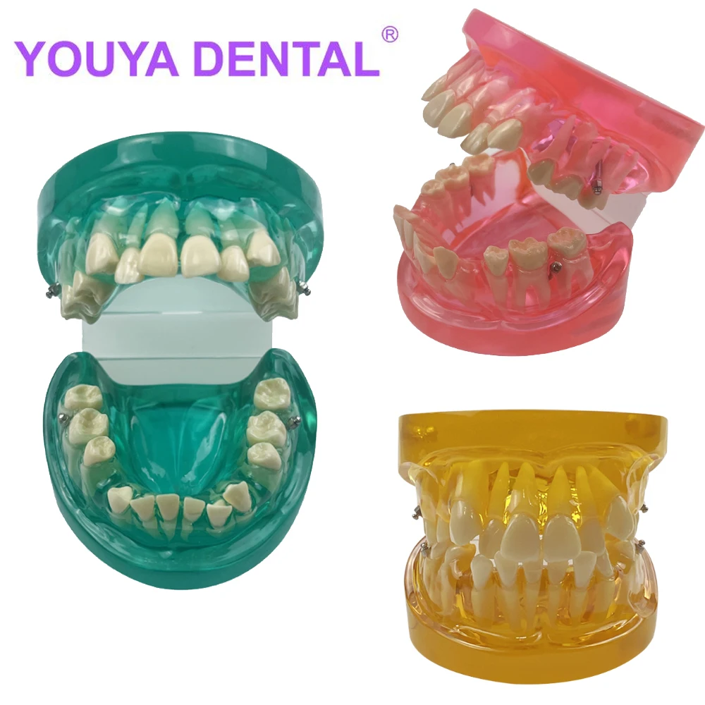 

1Pcs Orthodontic Tooth Teach Practice Model for Patient Communication Dental Study Clinic Model Tool Dental Standard Tooth Model