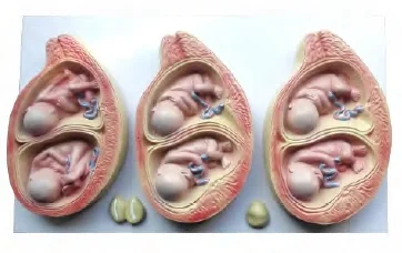 Twin Pregnancy Model Advanced Human Anatomy Medical Training Simulator