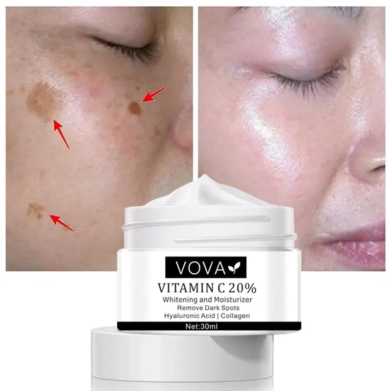 

Vitamin C Whitening Freckle Face Cream Remove Dark Spots Melanin Melasma Anti-aging Brighten Moisturizing Nourishing Skin Care