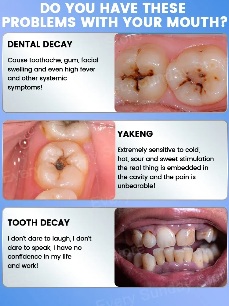 Scientific fluoride, tooth decay, best seller, tooth decay, plaque, yellow teeth, fresh breath