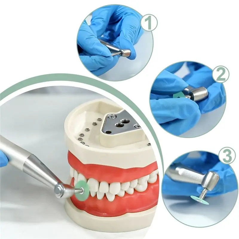 AB09 Dental Polishing Discs Gross Reduction Contouring Mandrel Stripe Set Dental Materials Teeth Whitening 80Pcs/Box