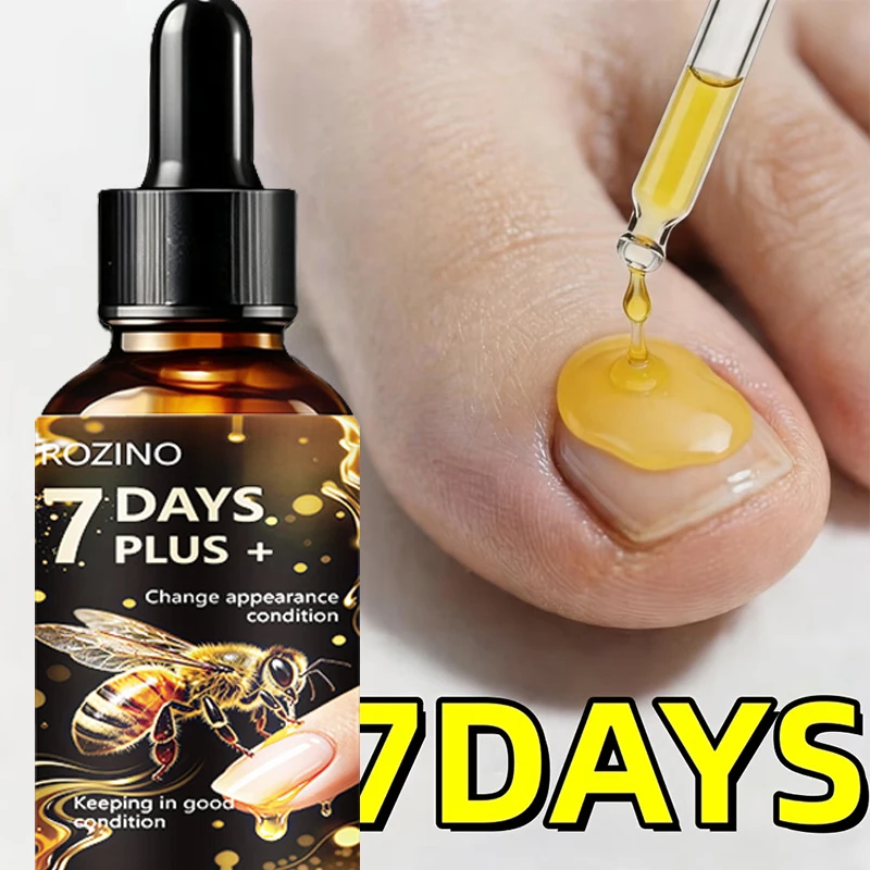 Super Powerful 7-Day Bee Venom Toenail Care Solution Plus+, 7-Day Nail Renewal, Maximum Strength -98% Change in Appearance, Maintains Good Condition, 5 Minutes to Prevent Spread, Renewal, Rapid Hardening, Enhances Nail Shine, Strengthens Nails, 24-Hour Continuous Care for Discolored, Thickened, and Damaged Nails, Prevents Nail Discoloration and Thickening, Promotes Nail Health, Improves Discolored, Damaged, Thickened, and Fragile Nails