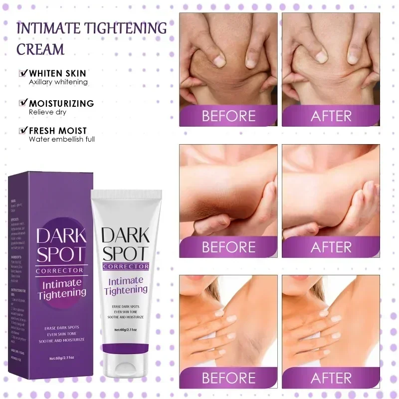 Nicotinamide Whitening Cream for Dark Skin Effective Lighten Thigh Inner Bleach Remove Dull Melanin Private Parts Brighten Cream