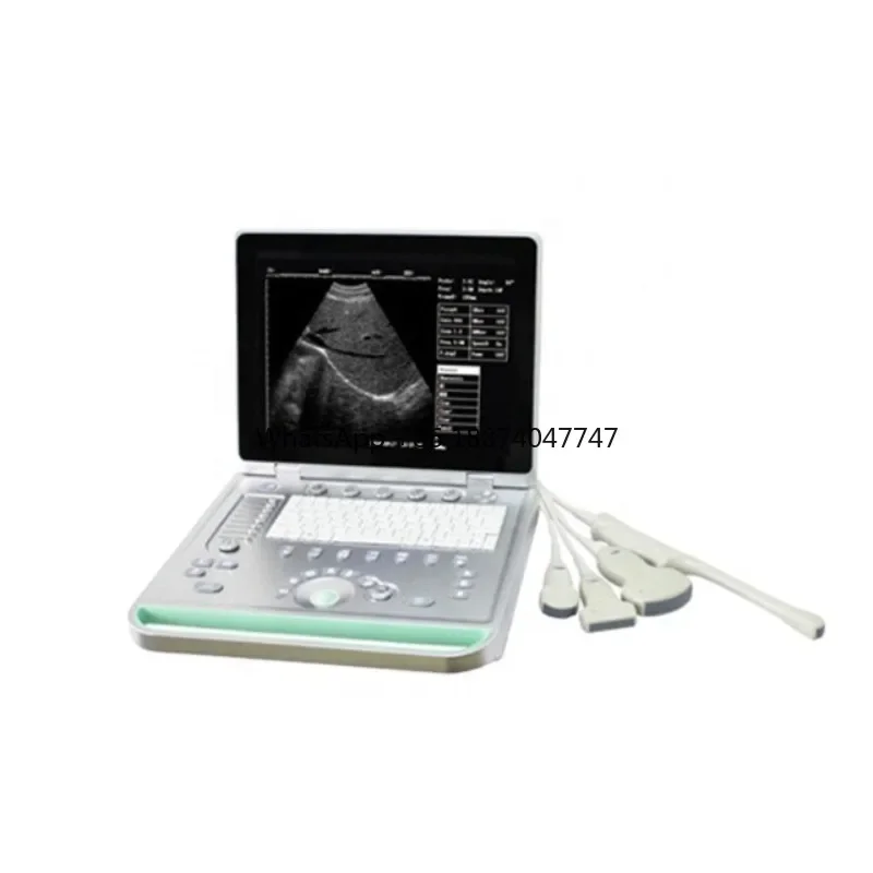 Professional Wireless Portable Handheld 3d Laptop Ultrasound 20mhz Liner Scan Ultrasound Scan Head Digital B-ultrasound Scanner