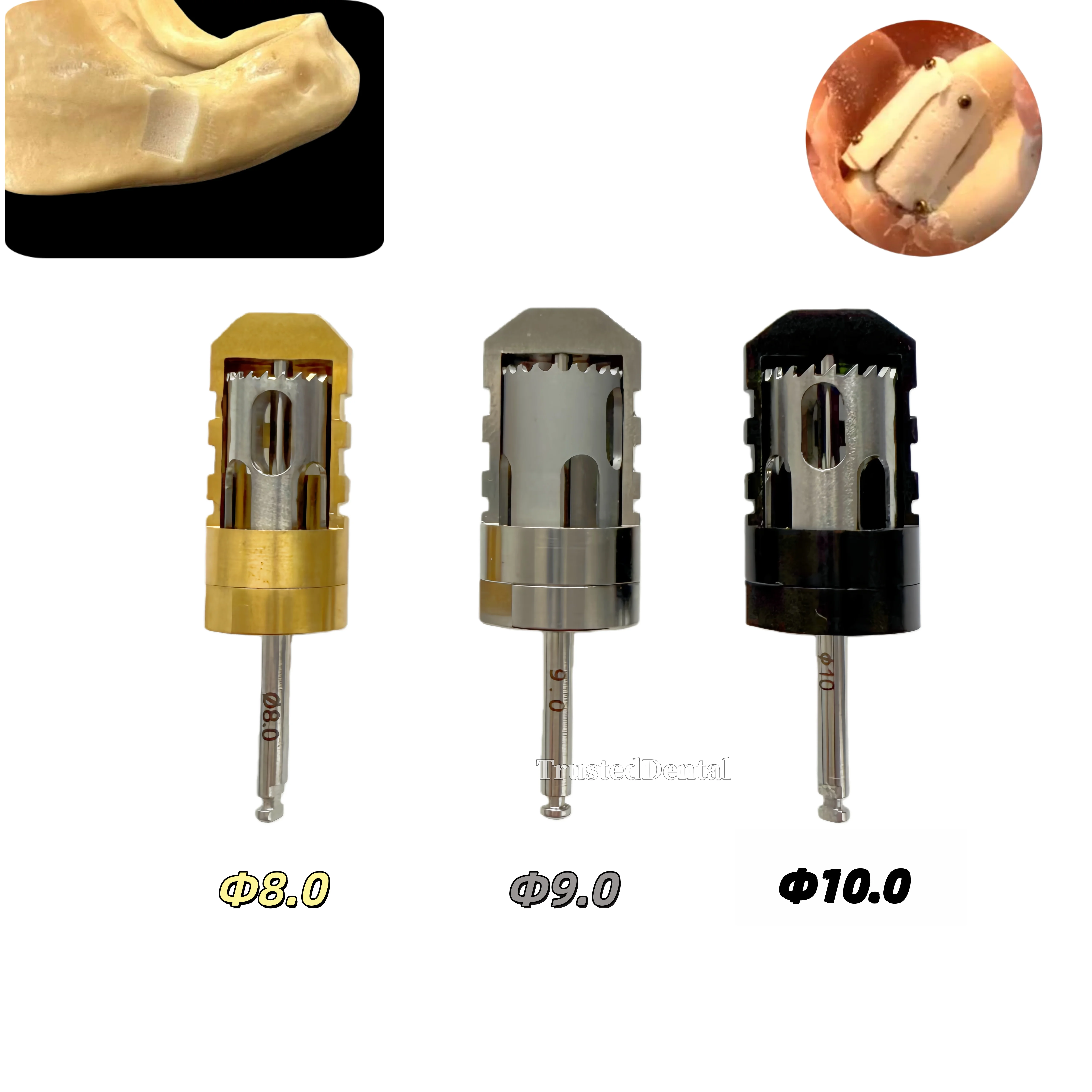 

Dental Half Month Bone Sampling Drill Bone Incremental Bone Slice Drilling Dental Implant Ring Drill 8.0/9.0/10.0mm
