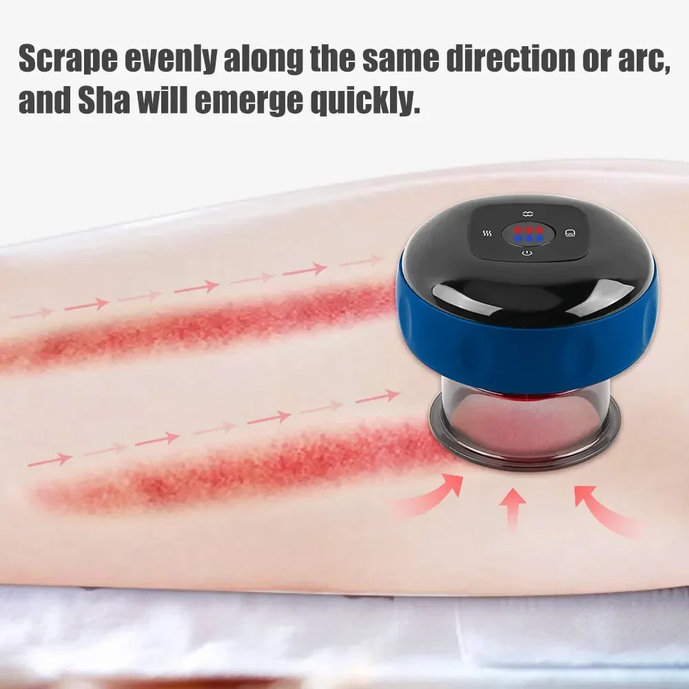 USB قابلة لإعادة الشحن فراغ الحجامة التدليك ، مكافحة السيلوليت ، العلاج المغناطيسي ، غواشا كشط ، الموقد الدهون ، التخسيس ، الجسم #5