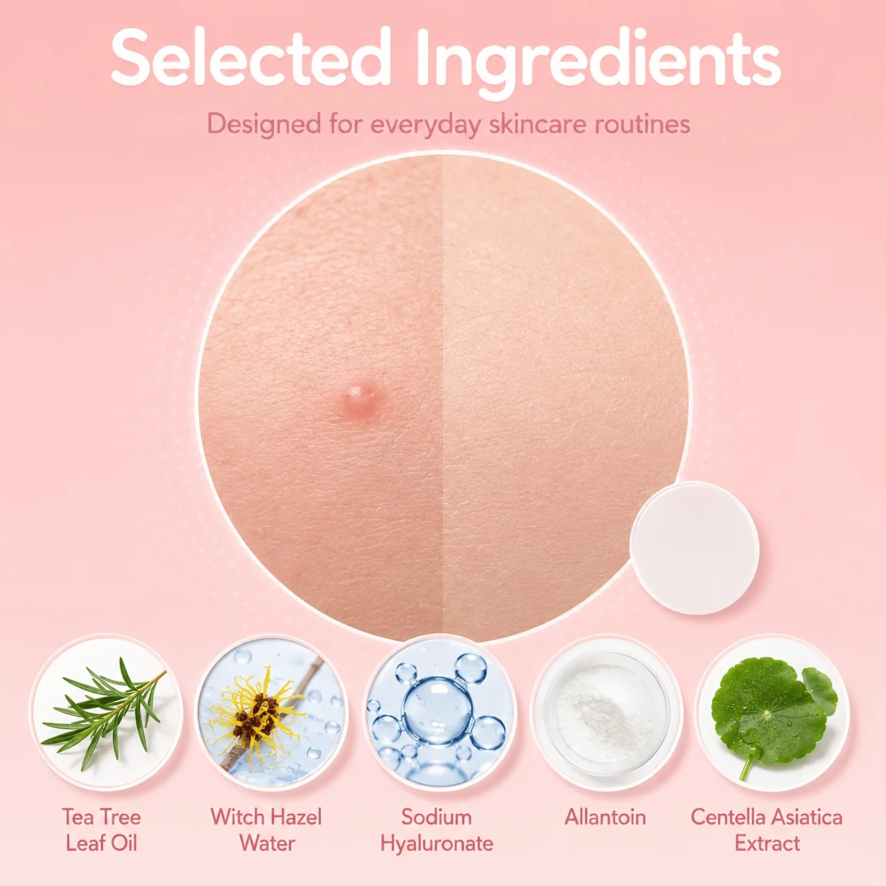 240/480/720pcs Hydrocolloid Blemish Cover Patches, Tea Tree Oil Spot Stickers, Invisible Look Face Patches For Daily Beauty Rout view 3