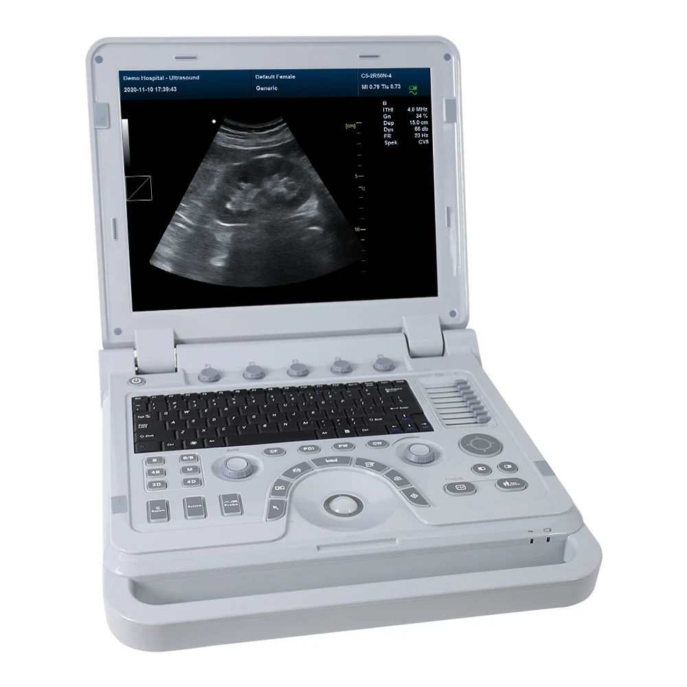 CONTEC CMS1700B portable ultrasound machine color doppler echocardiography medical ultrasound instruments