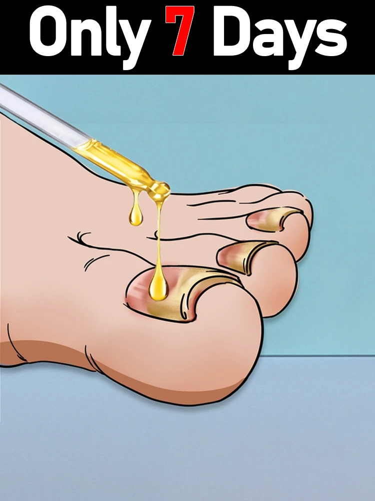 

Новое улучшенное масло для ногтей, устраняет грибок ногтей на ногах, попрощайтесь с проблемами с ногтями.