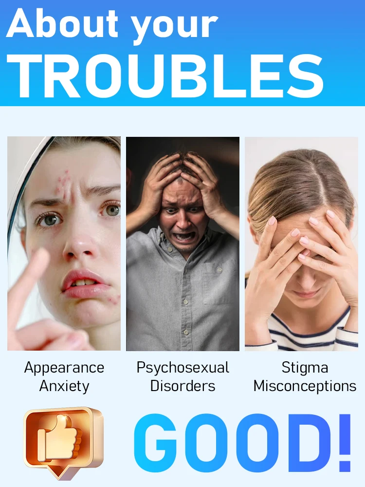 2025年新改良ブルーライトペンで、様々ないぼの問題を自宅で簡単に解決