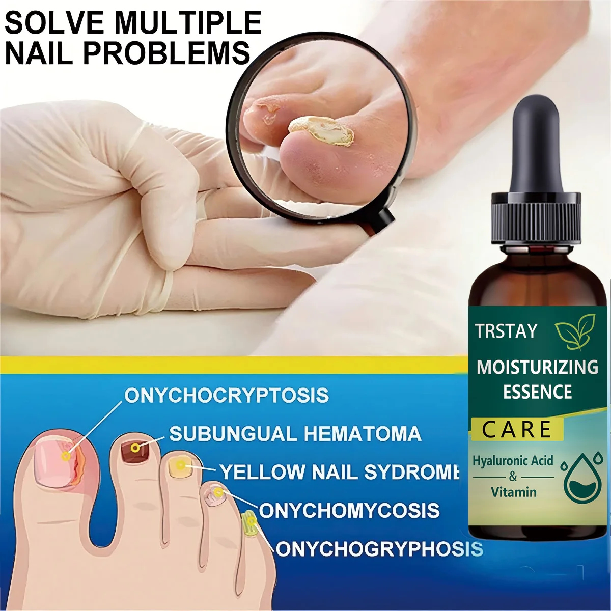 7DAYS Repair Nail Fungus Treatments Essence Foot Care Serum Toe Nails Fungal Removal Gel Anti-Infection