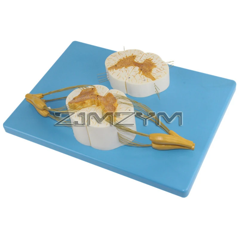 نموذج تشريحي للعمود الفقري البشري الموسع 5 مرات مع حبل العمود الفقري العصبي مع فروع الأعصاب وسائل طبية #5