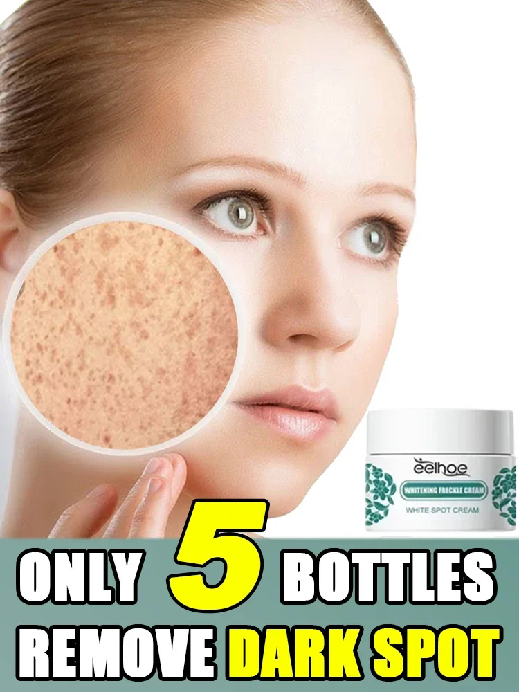 Removes Dark Spots Whitening Freckle Brightens Facial Skin Tightens Reduces Melanin Lightens Dark Skin