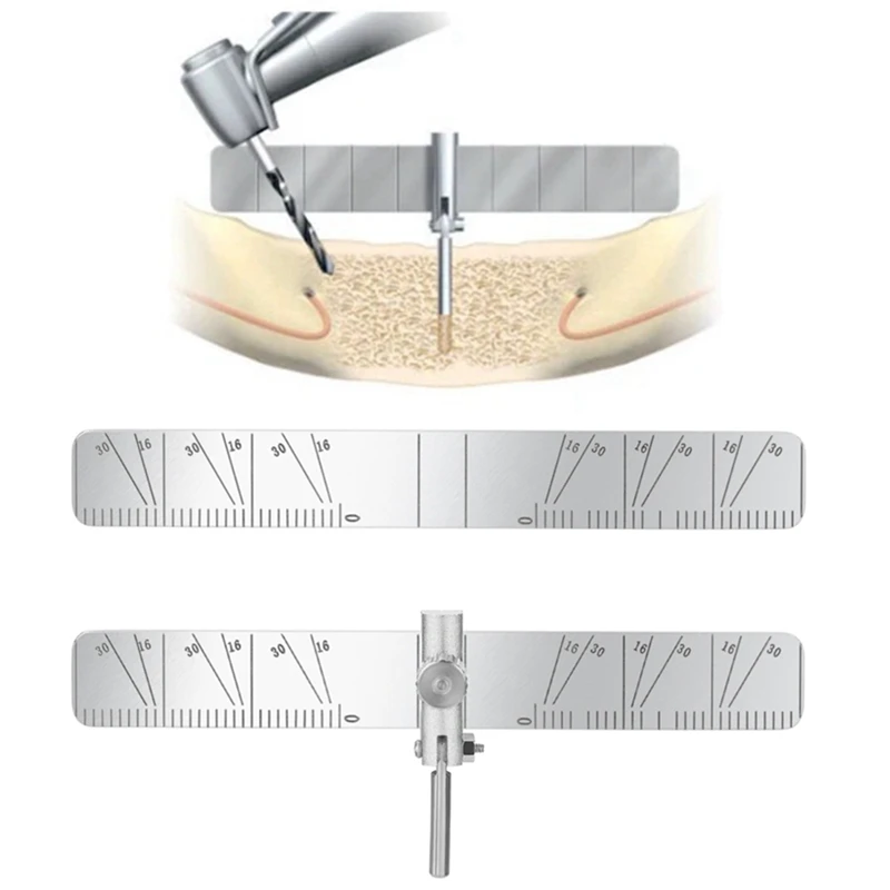 

Dental Implant Locating Guide Surgical Guide Kit Planting Positioning Locator Angle Ruler Implant Tools Dentistry Material