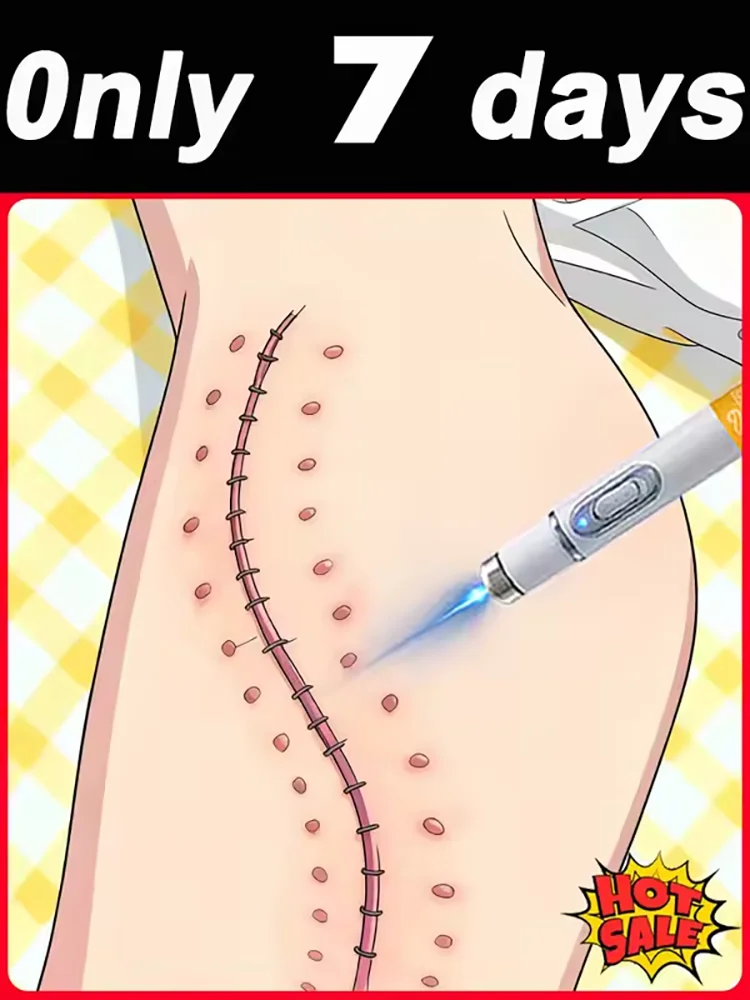 

Модернизированный шрам 3-го поколения ремонт корней шрамов uickly