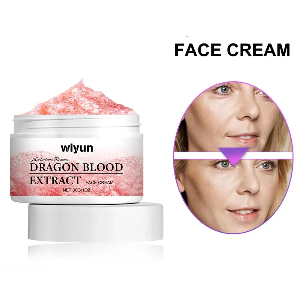 Crema de sangre de dragón, corrector hidratante Facial, crema de lucha para la piel, cuidado fácil, rejuvenecimiento, cuidado del envejecimiento, U5U9, 50g