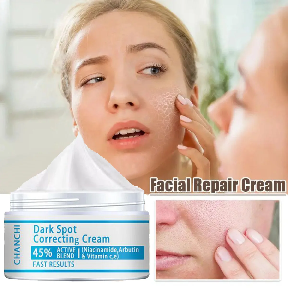 hyaluronic acid cream to lighten acne marks skin care  firming skin tightening cream