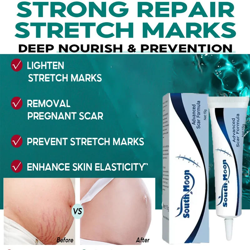 

Stretch Mark Vanishing Cream Firm Lift Skin Body Cream Pregnant Women Anti-Aging Anti-Winkle Cream Increase Elasticity Smooth