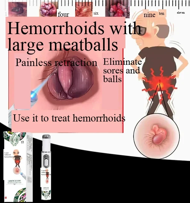 

Soothe & Shrink Hemorrhoid Lumps - For Internal & External Relief, Non-Invasive Comfort