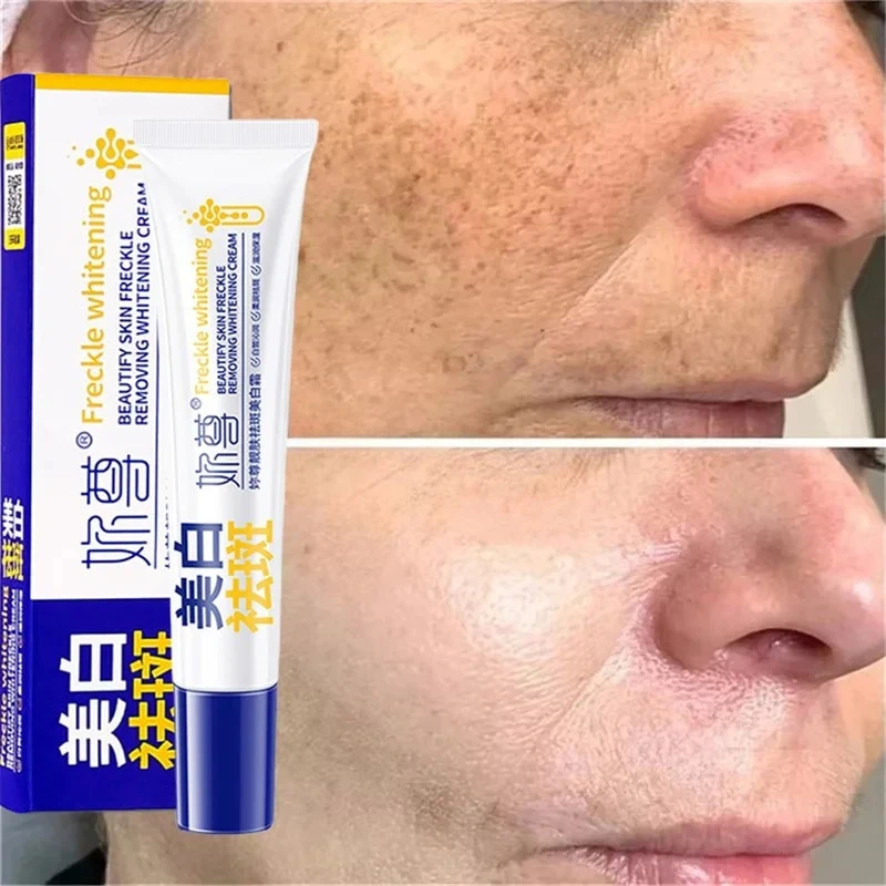 Crème blanchissante puissante anti-taches, éclaircissante pour la peau, élimine rapidement la Pigmentation de la mélanine, les taches foncées, soins coréens pour la peau du visage