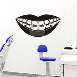 Dental Barces Wall Art Decal Teeth Care Clinic Decoration Dentist Service Vinyl Sticker Mouth Removable Poster