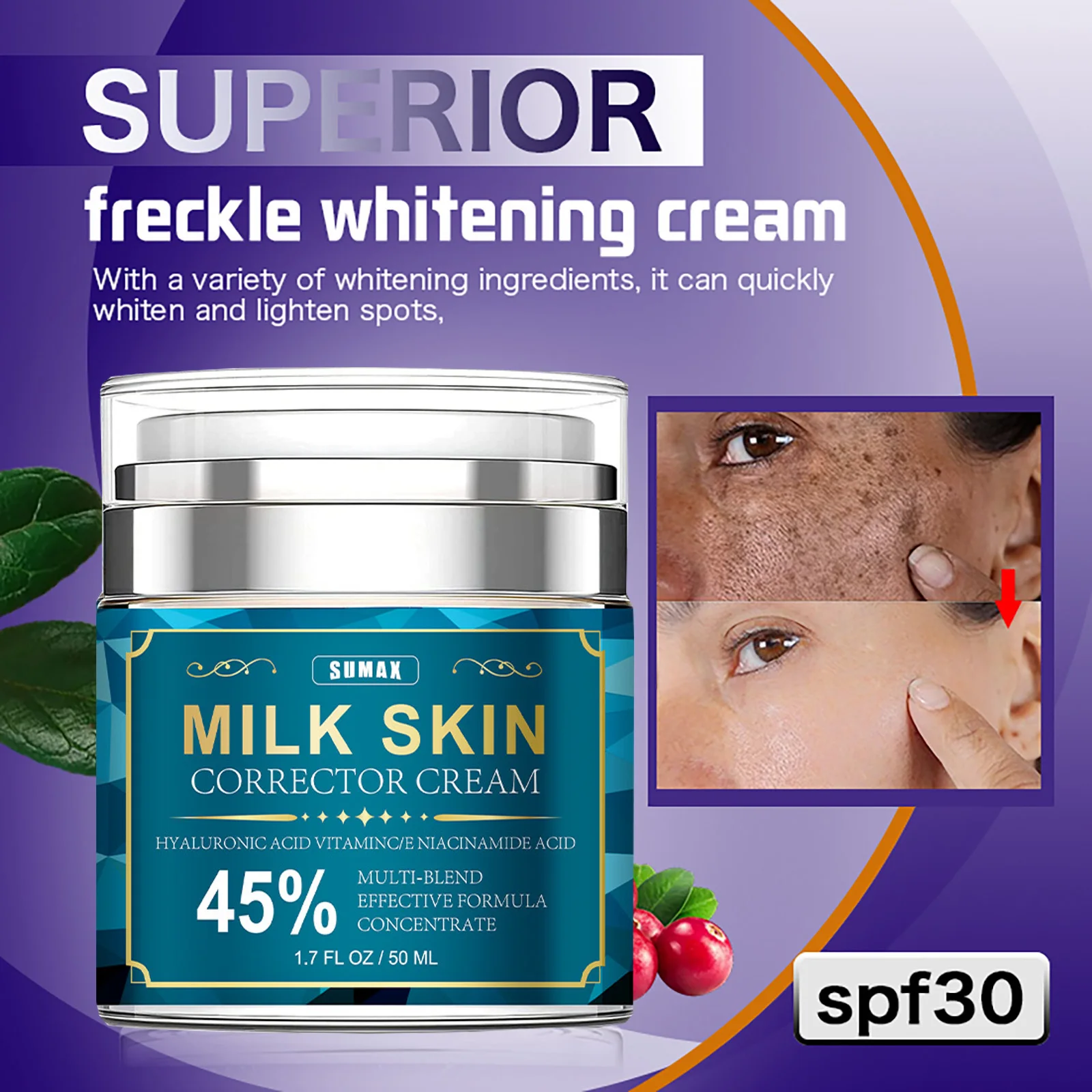 Milk Skin Dark Spot Remover for Face, Hyperpigmentation, Melasma, Freckle, Sun Spots Removal, Whitening Cream for Women and Men