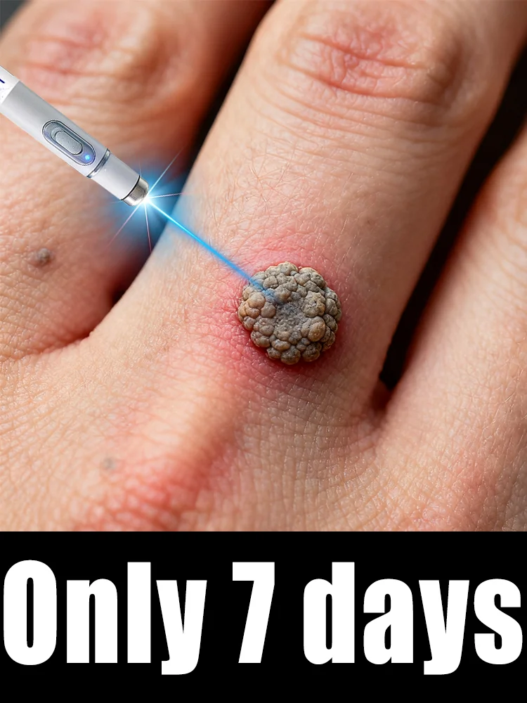 Hᴏᴛ sᴇʟʟɪɴɢ ʙʟᴜᴇ ʟɪɢʜᴛ ᴘᴇɴ ᴛᴏ sᴏʟᴠᴇ ʙᴏᴅʏ ᴡᴀʀᴛs, ᴡᴀʀᴛ ᴄᴀʀᴇ ᴛᴏᴏʟs