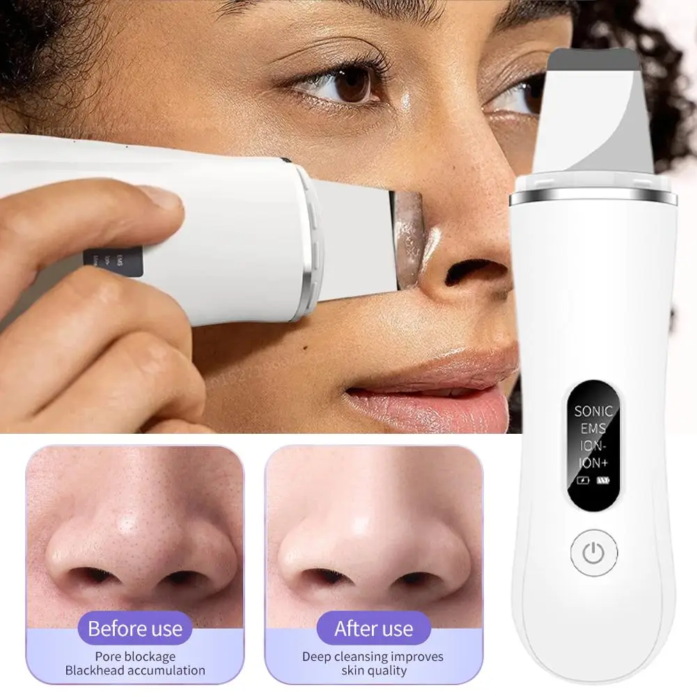 Ultradźwiękowy skrobak do skóry LED, lifting i ujędrnianie skóry, szpatułka EMS, jonowa głęboka oczyszczanie porów twarzy, urządzenie do usuwania zaskórników