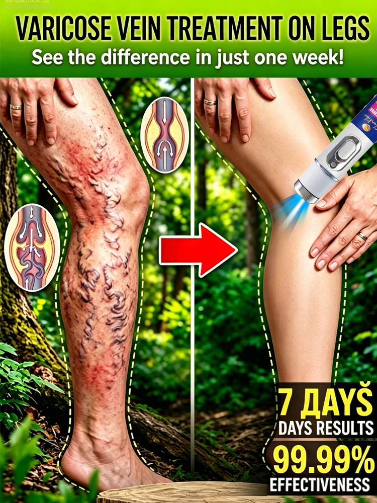 

Don't wait until your legs swell to regret it.