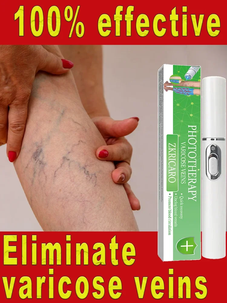 Powerful Laser Therapy for Moderate Varicose Veins，Clear varicose veins，Vasculitis，Repair varicose veins in 7 days