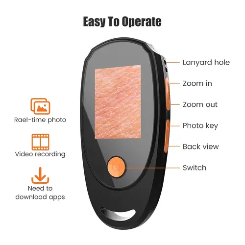 Imagen 2 del producto Dermatoscopio portátil analizador de piel microscopio Digital con pantalla IPS 1080P, lupa 500X para cuero cabelludo/pelo Trichomes faciales