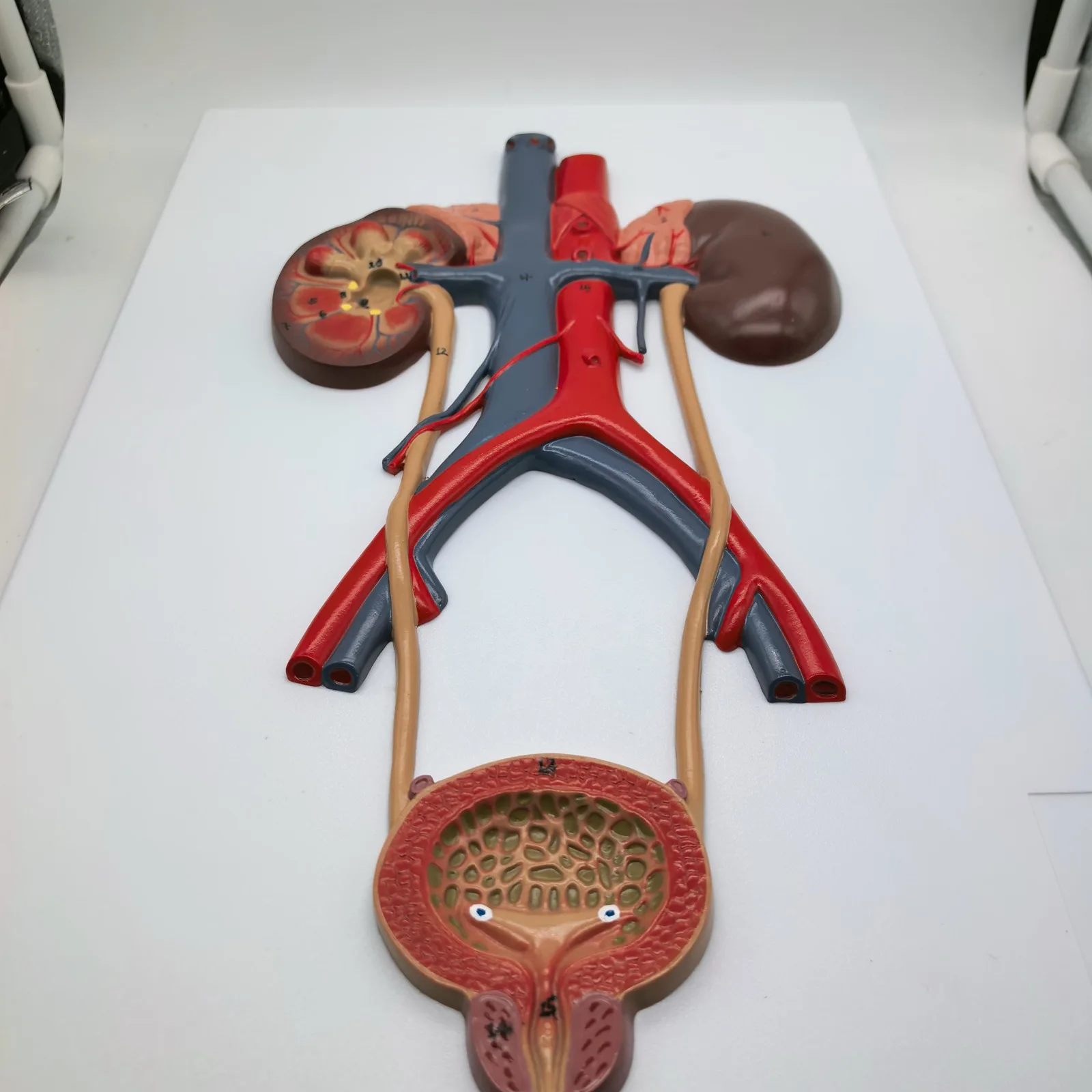 PVC Anatomy Teaching Model Medical Bladder Liver Kidney Wall Plaque Urinary System
