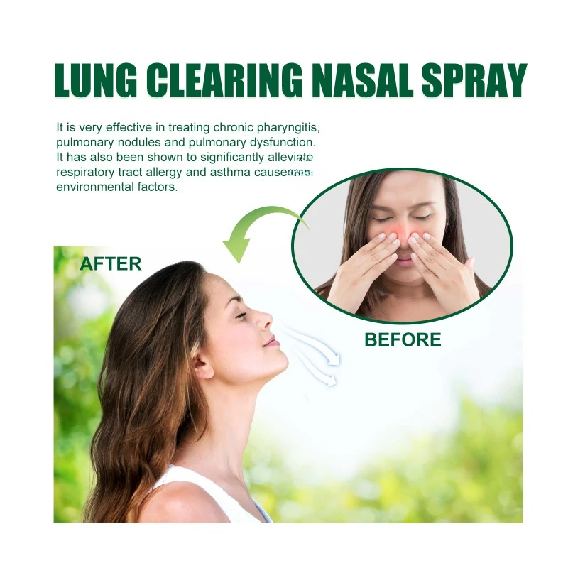 Espray Nasal para limpieza de pulmones, purifica y nutre los pulmones, alivia la obstrucción Nasal, elimina la incomodidad Nasal, deja de roncar, espray Nasal