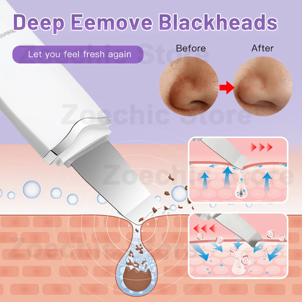 Ultrasonic Skin Scrubber Pore Cleaning Facial Deep Exfoliator Scraper and Blackhead Remover Female and Male Beauty Instruments