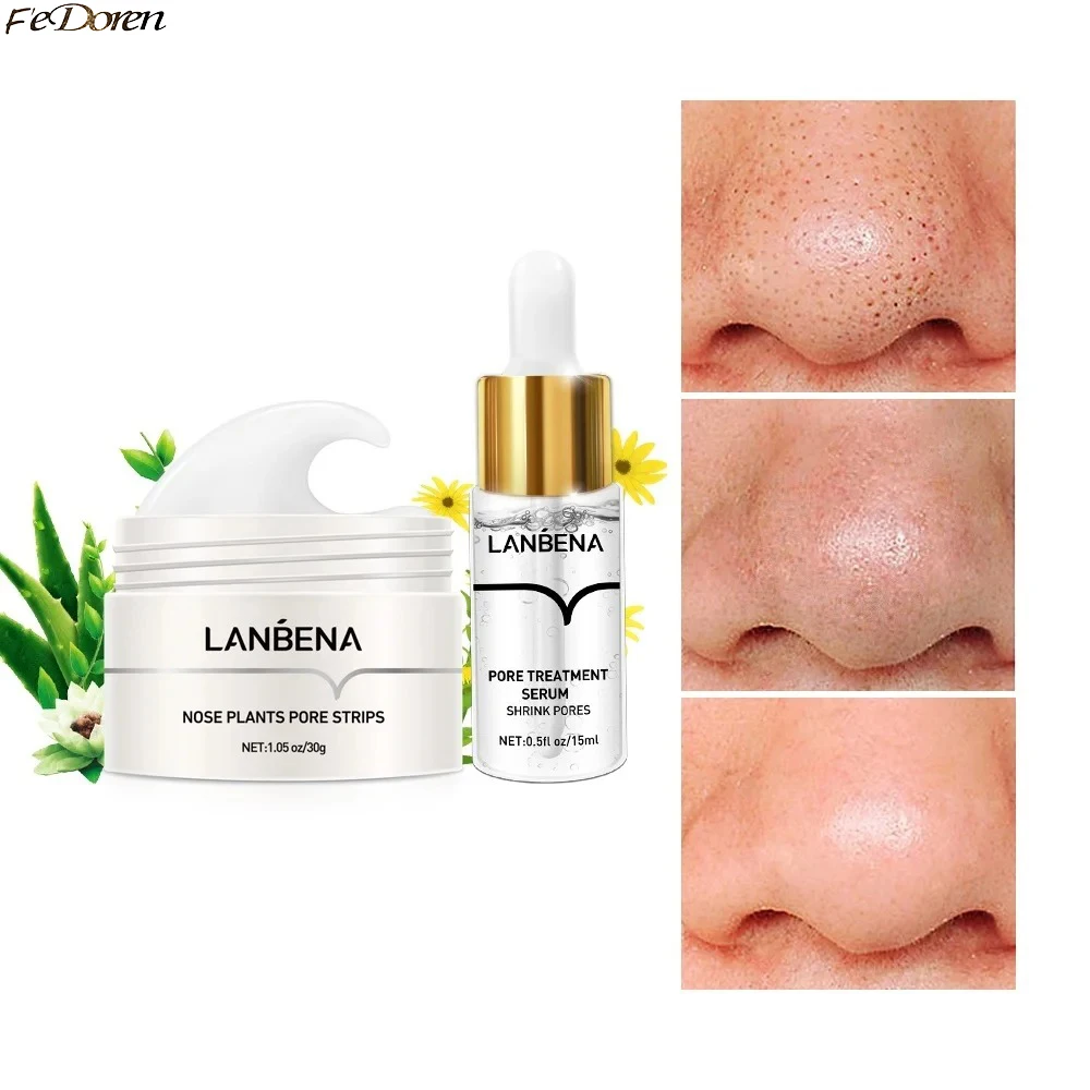 LANBENA Ботанические полоски пор для носа, 30 г, глубоко очищающая сыворотка для лечения пор от черных точек, 15 мл, сужающая поры, прочная, гладкая кожа лица