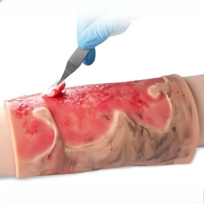 

Wearable 2-3 Degree Limb Burns Training Module High Simulation Limb Burn Model Medical Student Nurse Training Model