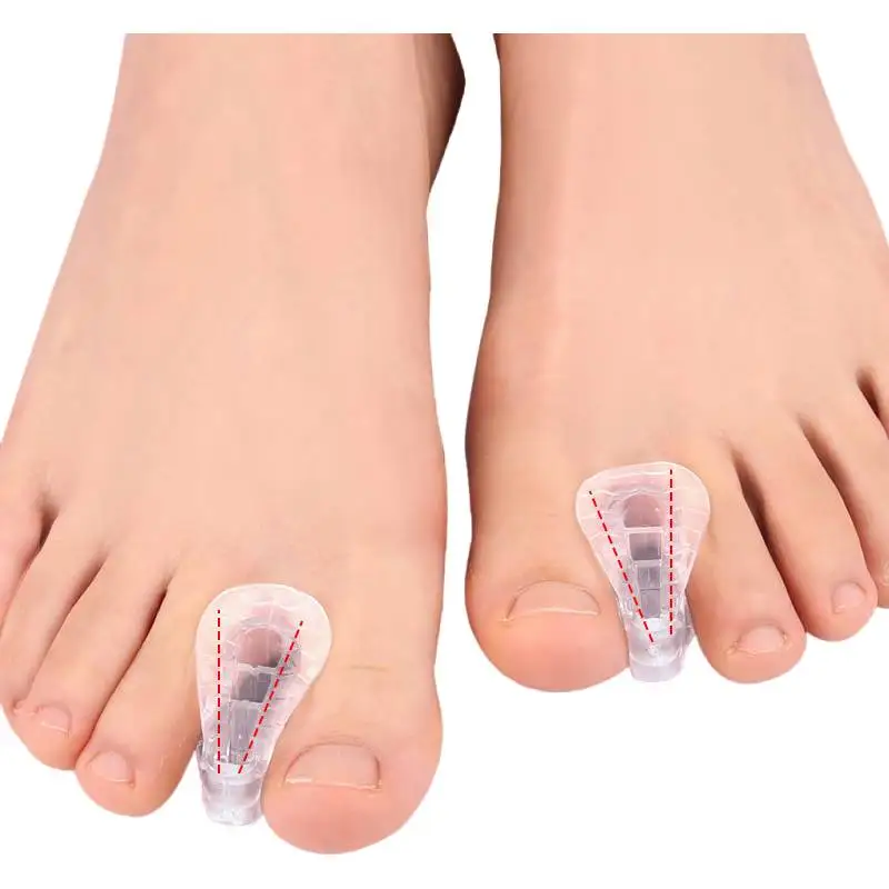 Separadores de dedos de los pies 4pairs hallux valgus bunion corrector Hammer corrector de dedos de los pies dolor aliviado herramienta ortopédica de pedicura