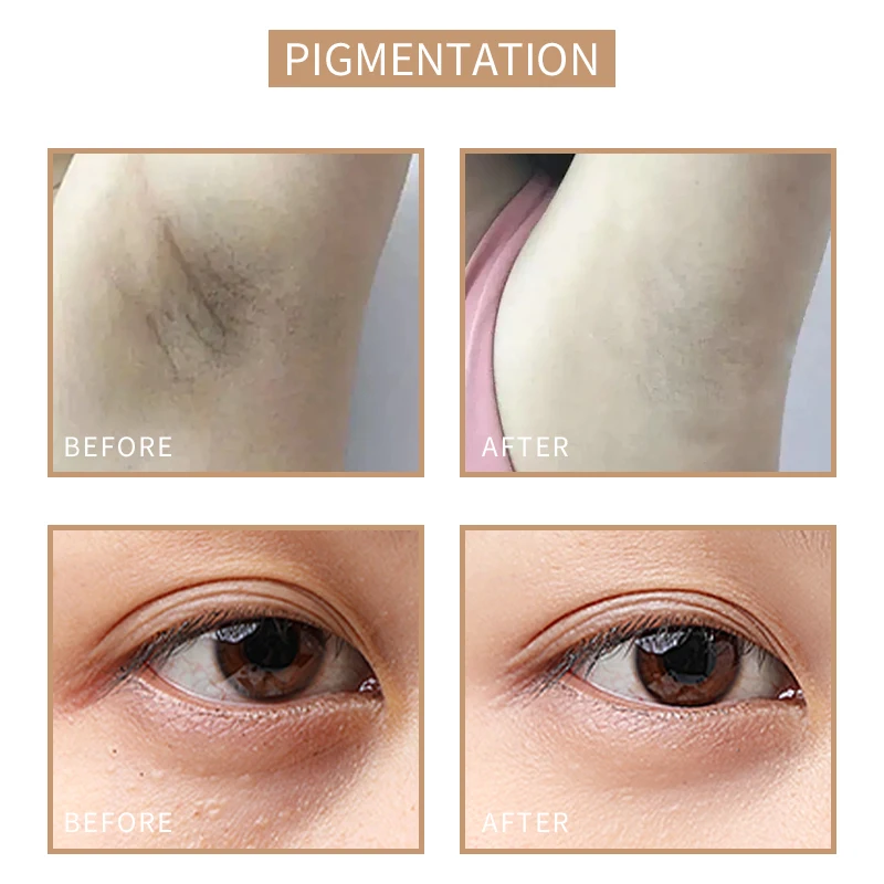 Tintas de tatuaje SOBER-SKIN para reconstrucción del tono de la piel pigmento de maquillaje permanente profesional para estrías de cicatrices tinta de Microblading