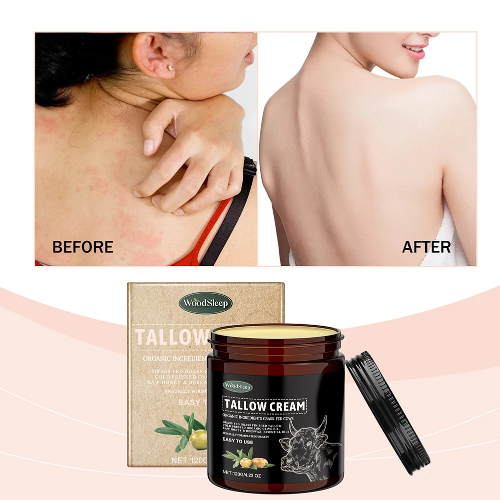 

120g Beef Tallow For Skin,Tallow Cream Skin Moisturizer Fast-Absorbing Formulas Body Elasticity Nourishing Cream Beauty Product