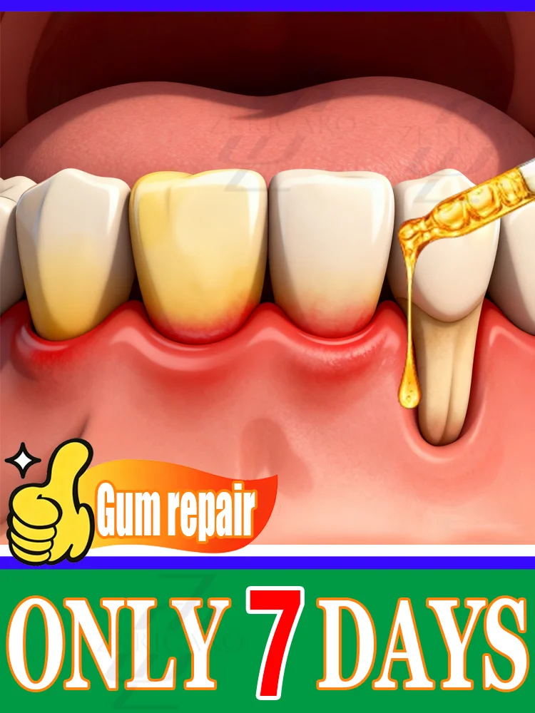 

With ᴇᴀsᴇ restore gum health and blanket teeth ᴏᴠᴇʀ ᴀ 7-ᴅᴀʏ ᴘᴇʀɪᴏᴅ