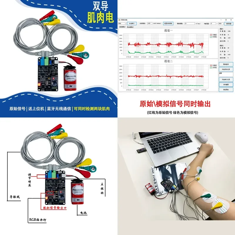 Dual Conductor Muscle Electrical EMG Sensor Kit Smart Wearable Device Multi Channel Custom Muscle Signal Detection