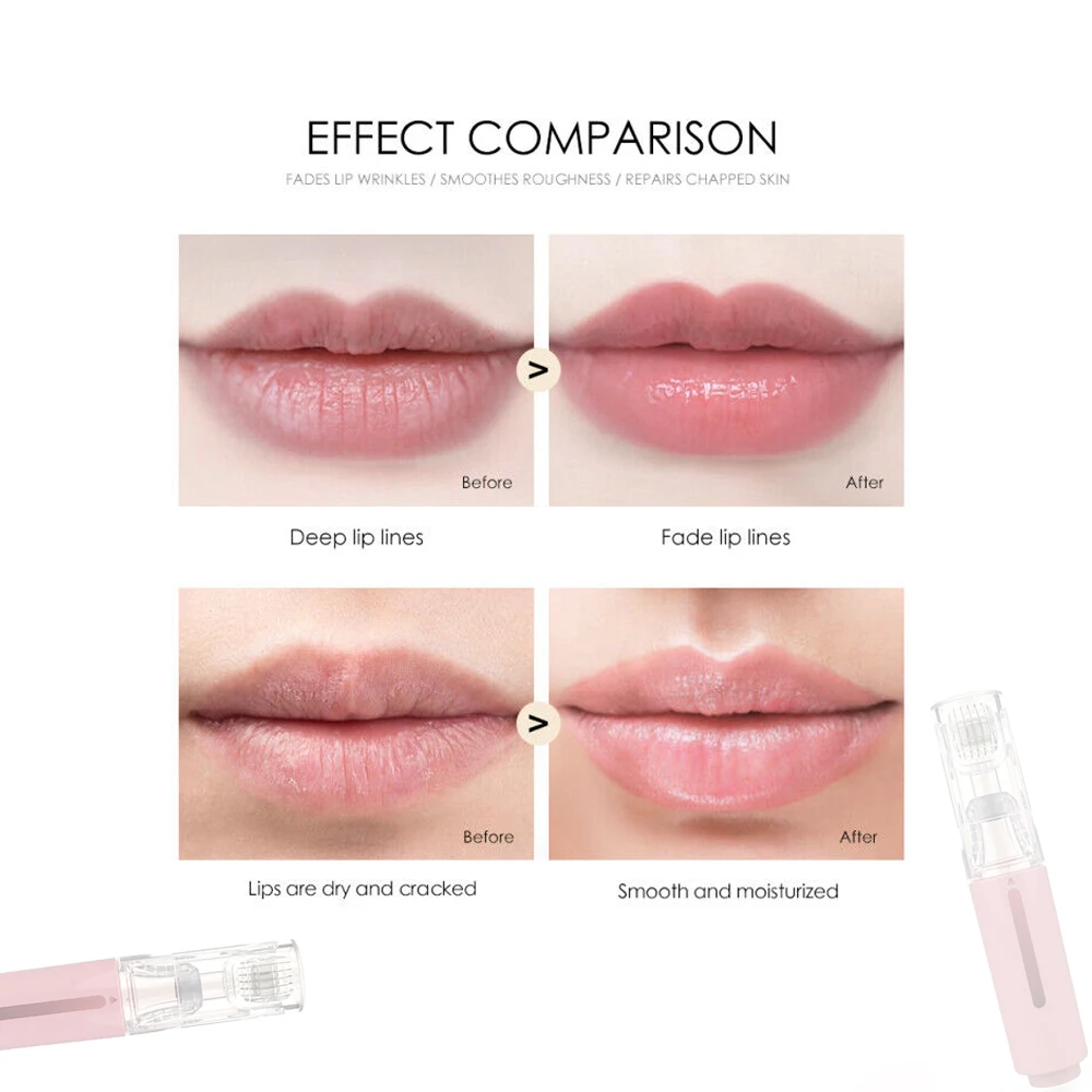 105 Nadeln Titan-Dermaroller Mikronadeln Gesichts-Lippen-Booster Dermaroller Mikronadel für Gesichtsmassage Schönheit Haar Haut 0,2mm – Detail 3