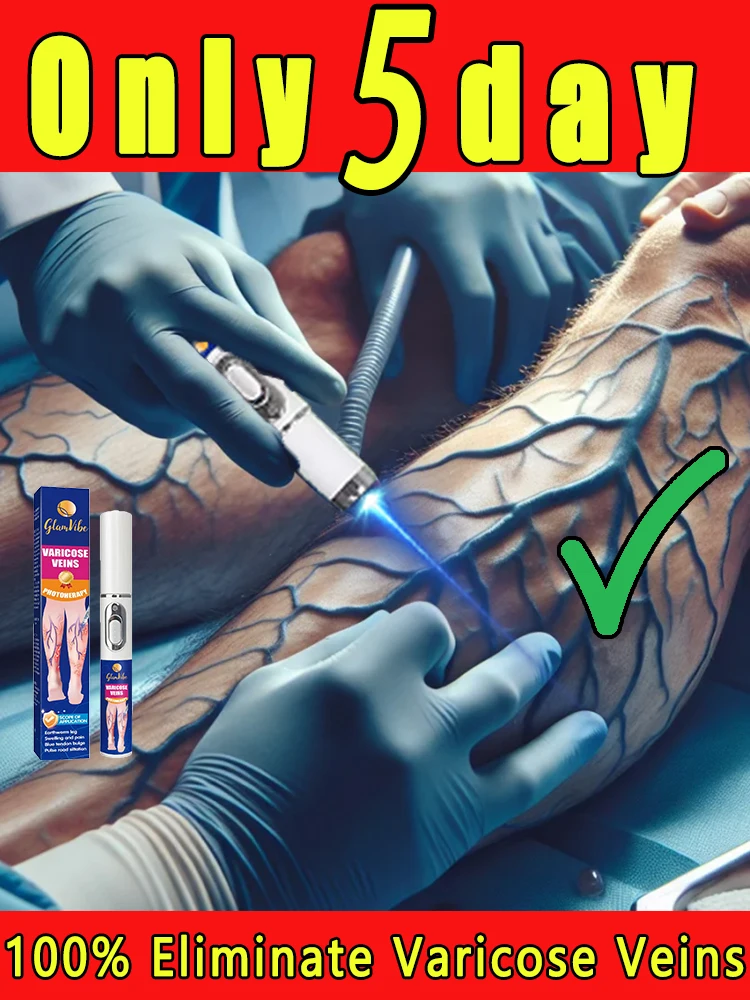 

Eғғᴇᴄᴛɪᴠᴇʟʏ ᴛʀᴇᴀᴛ ᴠᴀʀɪᴄᴏsᴇ ᴠᴇɪɴs ᴀɴᴅ ᴏ̨ᴜɪᴄᴋʟʏ ɪᴍᴘʀᴏᴠᴇ ʟᴇɢ ᴄᴏᴍғᴏʀᴛ. Tʜᴇ ʙᴇsᴛ ʜᴏᴍᴇ ᴛʀᴇᴀᴛᴍᴇɴᴛ ᴏᴘᴛɪᴏɴs ᴏғ 2025.