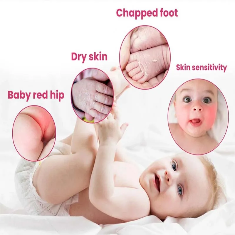 40g Safety Baby Kid Skin Care Infant Toddler Anti Dry Face Cream Moisturizing Body Milk Multi-effect Moist Hydrating Body Lotion