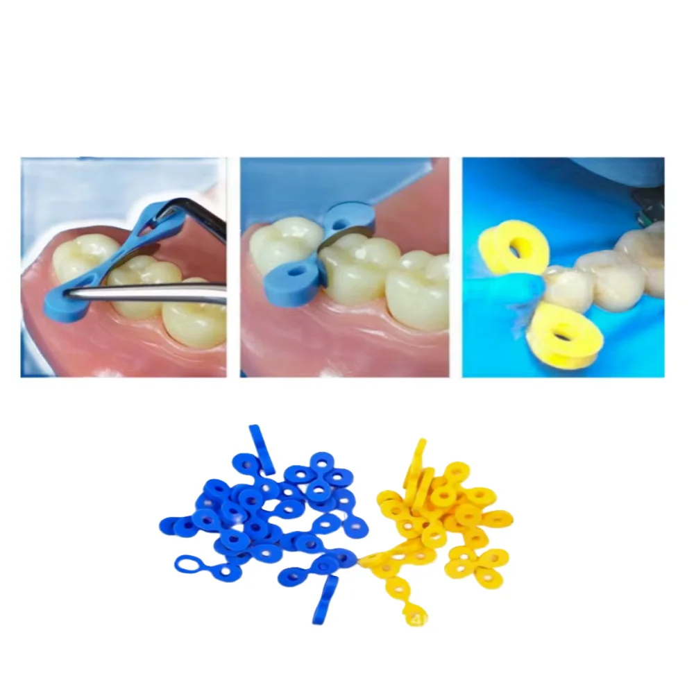 

40 шт. стоматологические эластичные клинья-матричные сепараторы зубов для безопасного межзубного приготовления в реставрационных процедурах и стоматологических инструментах