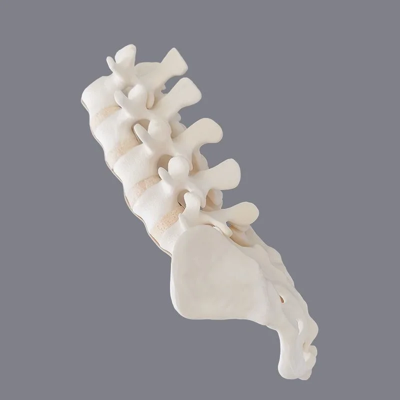 Sawbones Solid Foam Human Lumbar 1 ถึง Sacrum Lumbar Spinal Model พร้อมรากเส้นประสาทสําหรับศัลยกรรมกระดูก