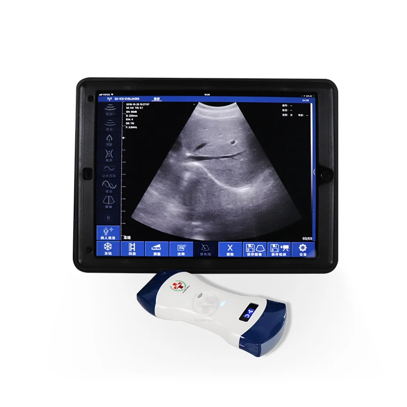 SY-AC51 Wireless 128 Elements Mini Double Probe Scanner Linear/Convex/Phased Array 3 in 1 Pocket ultrasound